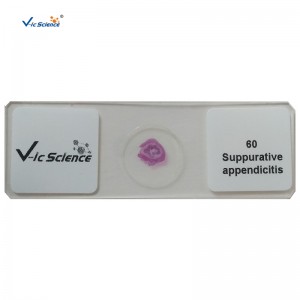 100 ชิ้นชุดมนุษย์พยาธิวิทยาสไลด์กล้องจุลทรรศน์เตรียมสไลด์