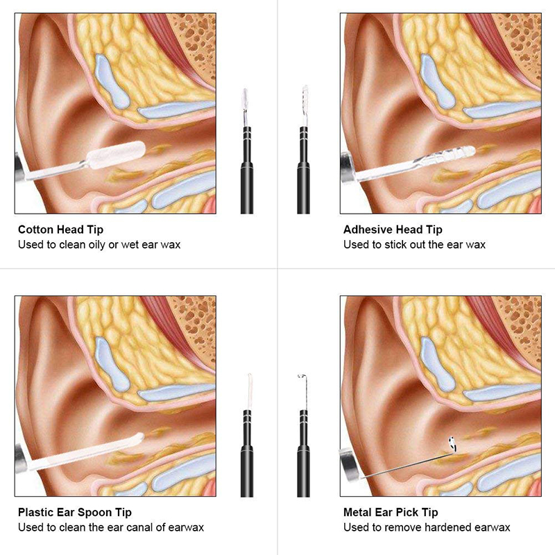 Wifi Otoscope 3 in 1 หูขี้ผึ้ง Remover เครื่องมือ 720 จุดกล้องกันน้ำพร้อม 6 LED ปรับได้เข้ากันได้กับ Android และ iOS
