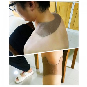 แพทช์บรรเทาอาการปวด