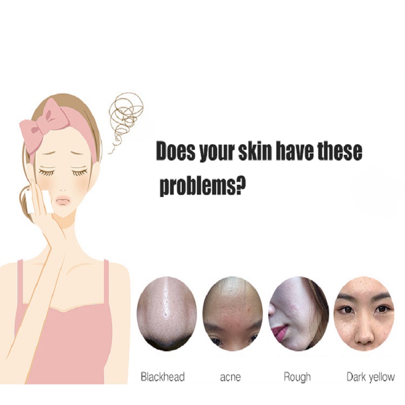 การทำความสะอาดลึก Exfoliators ฟื้นฟูผิวหน้ายกผิวหน้าอัลตราโซนิกผิวหน้า