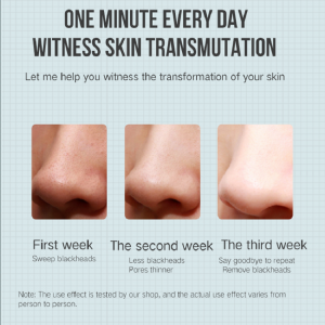 กำจัดไฟฟ้าสิวกำจัดสิวหัวดำ Remover เครื่องเสริมความงามเครื่องสูญญากาศทำความสะอาดรูขุมขน