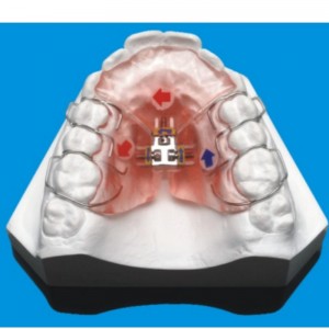 ซีรีส์ทันตกรรมจัดฟัน